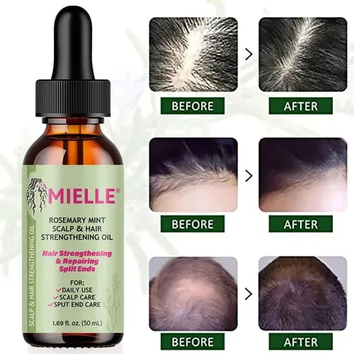 ACEITE DE ROMERO GLOW - BRILLO Y CRECIMIENTO NATURAL